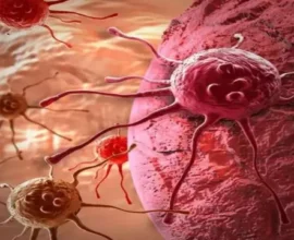 cancer 2 1769987430673 v