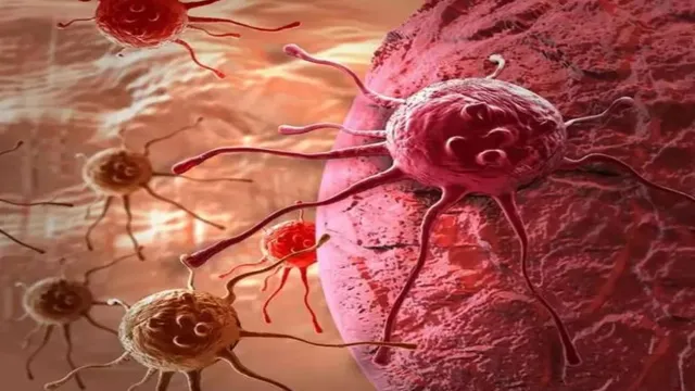 जयपुर में कैंसर पर बड़ी जीत, चिकित्सकों ने दूसरी बार सफल बोनमैरो ट्रांसप्लांट कर महिला को बचाया 2 cancer 2 1769987430673 v